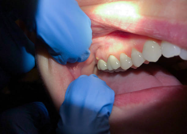 Urgent Tooth Repair in OH