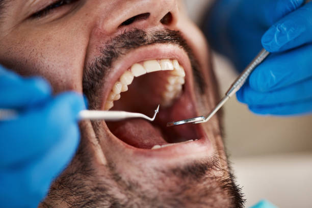 Best Urgent Tooth Repair  in Geneva, OH