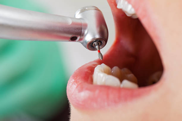 Best Emergency Gum Pain Relief  in Geneva, OH